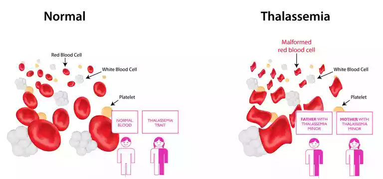 What is Thalassemia Trait Test?